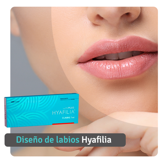 Perfilado y aumento de labios Hyafilia